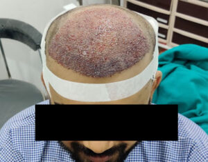 beforeafter-img-b3