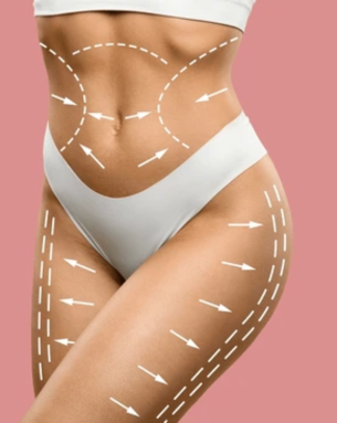 Body contouring treatment areas