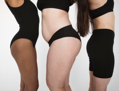 Exploring body contouring options